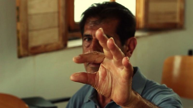 Descubren que el Huntington altera las neuronas desde que inician su desarrollo