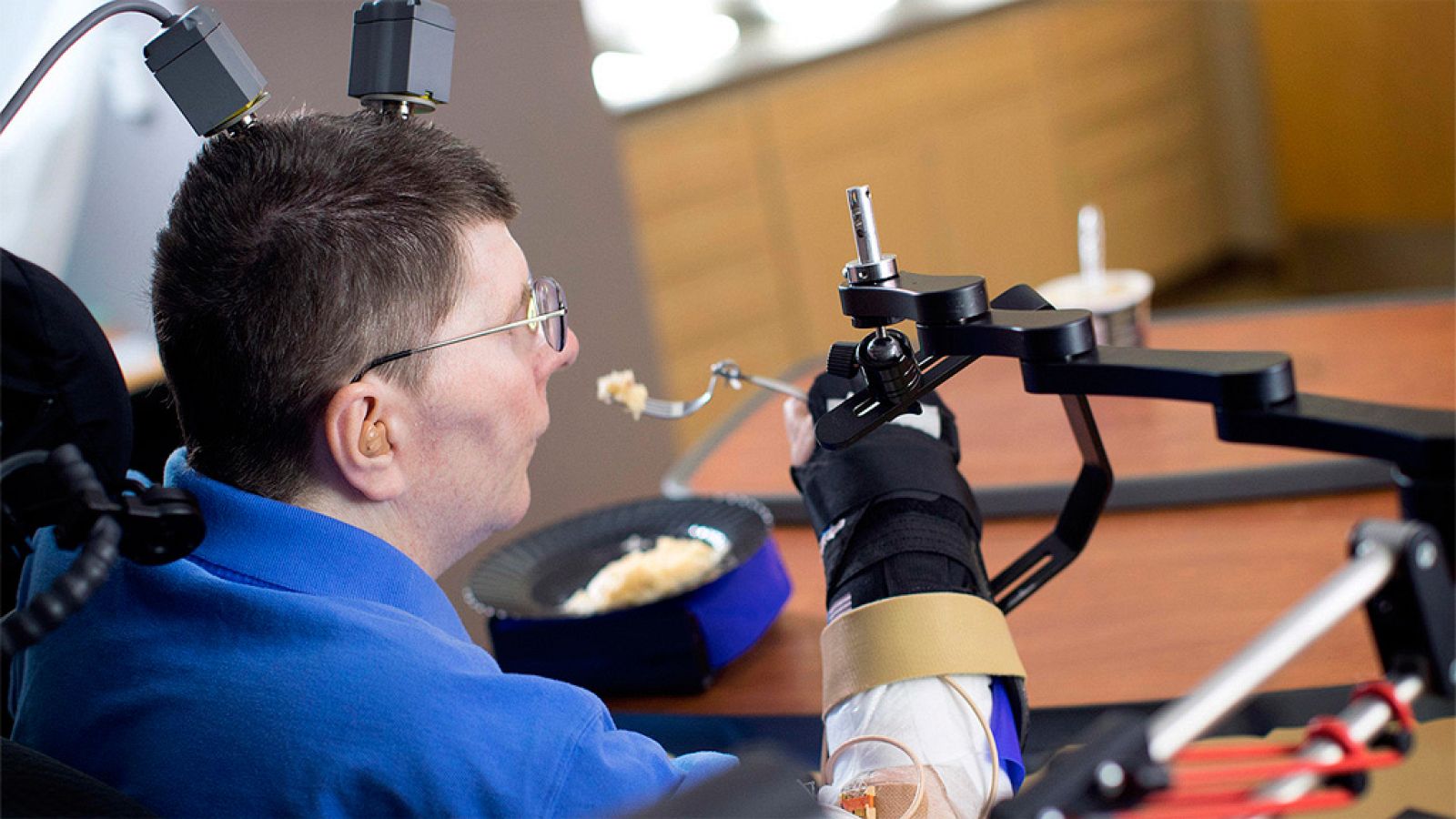 Un tetrapléjico vuelve a mover el brazo y la mano gracias a una neuroprótesis