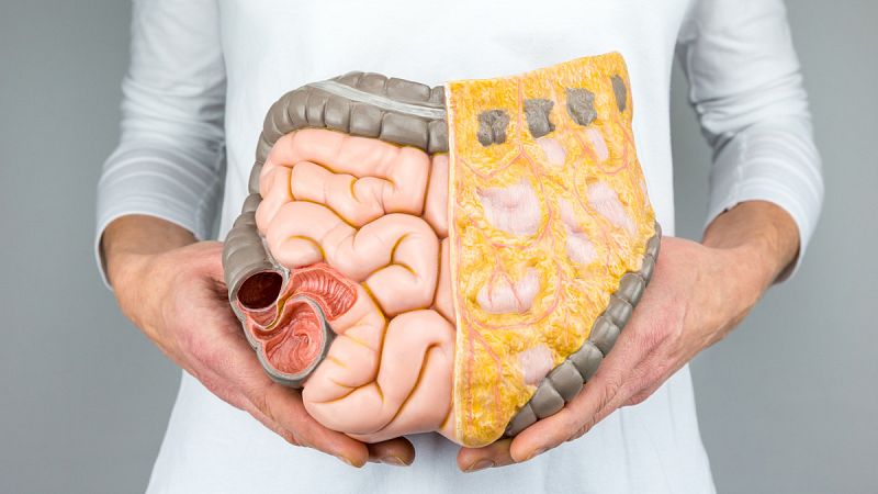 El cribado del cáncer de colon sólo cubre al 19% de la población de riesgo