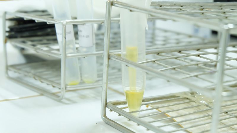 La activación de una enzima permite aliviar la enfermedad de Huntington