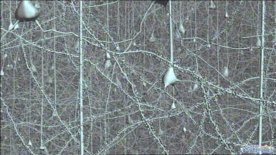 Frenar el p�rkinson / Ciudades inteligentes