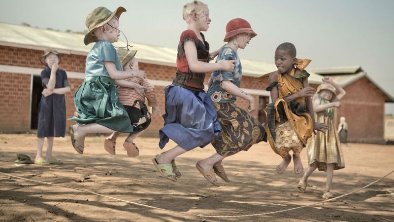Albinos: la vida lejos del sol