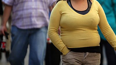 De lo más natural - ¿Estás gordo y no lo ves? - 06/08/17 - escuchar ahora