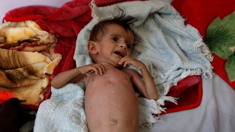 La ONU alerta de que Yemen sufre "la mayor crisis humanitaria del mundo"