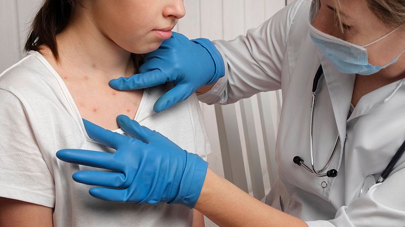 La caída en la cobertura de vacunación dispara los casos de sarampión en Europa