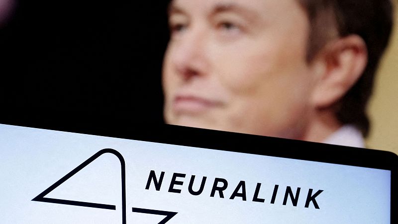Musk anuncia la implantación del primer chip cerebral de Neuralink en un ser humano
