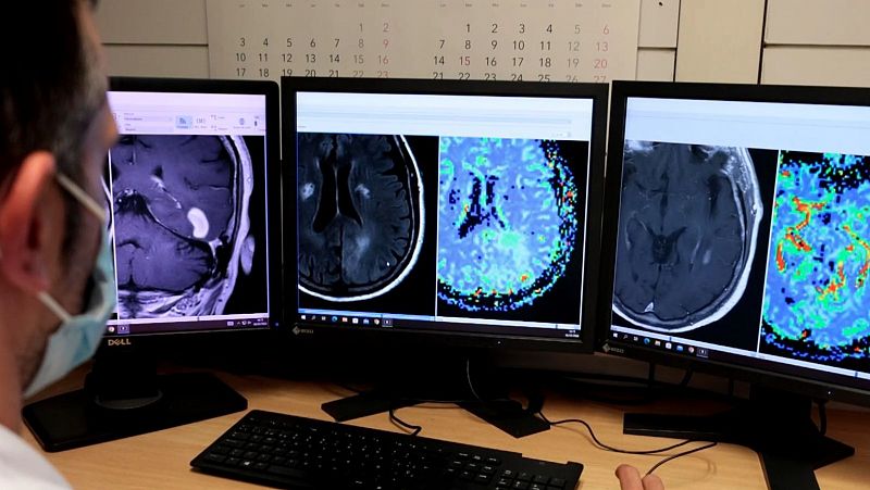 Cientficos disean una nueva herramienta de Inteligencia Artificial para el diagnstico de tumores cerebrales