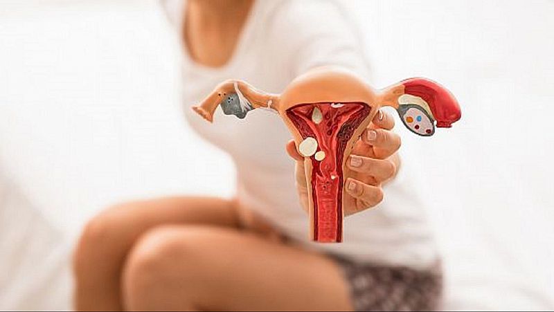 Com disminuir el dolor durant les relacions sexuals si tens endometriosi?