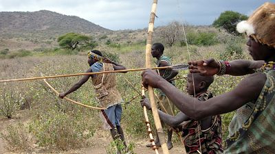 �Podemos vivir 70 a�os sin inflamaci�n?