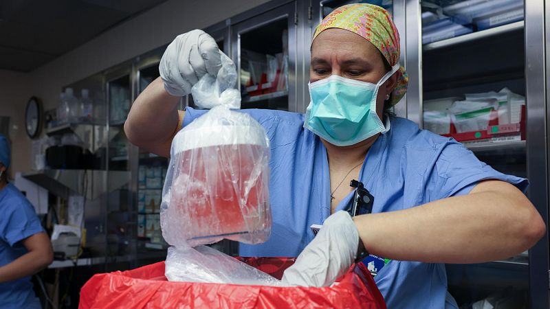 Muere el paciente que recibi el primer trasplante de rin de un cerdo modificado genticamente