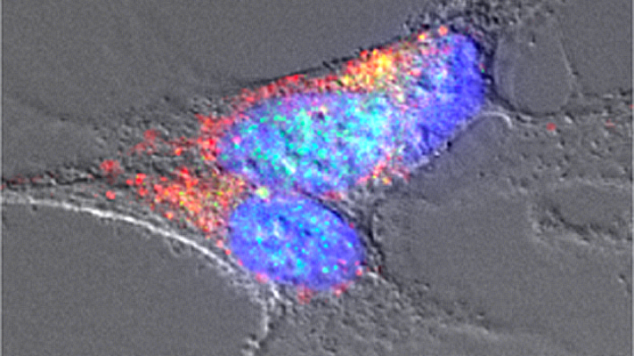 Imagen de microscop�a de neuronas tratadas con amiloides bacterianos en las que se detectan agregados de ?-sinucle�na. | IdAB-CSIC