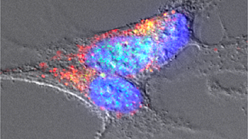 Investigadoras españolas encuentran una relación entre la microbiota intestinal y el párkinson