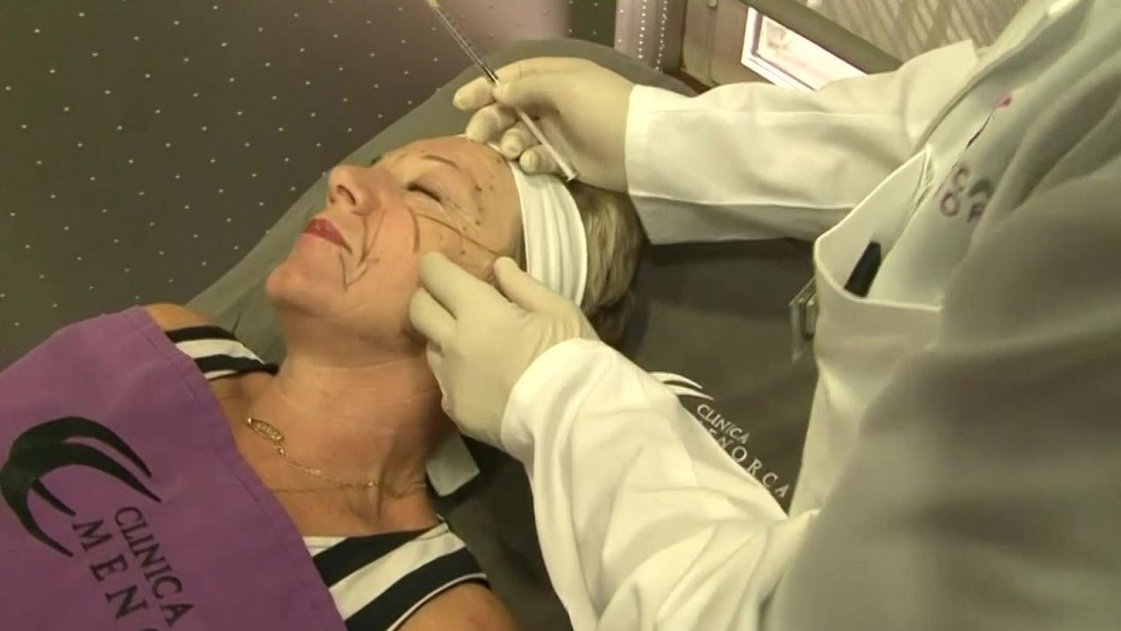 Els perills de l'àcid hialurònic | L'altaveu - L'altaveu | Veure