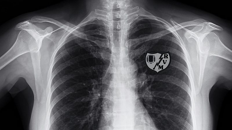 Una rayografía a 100 años de historia