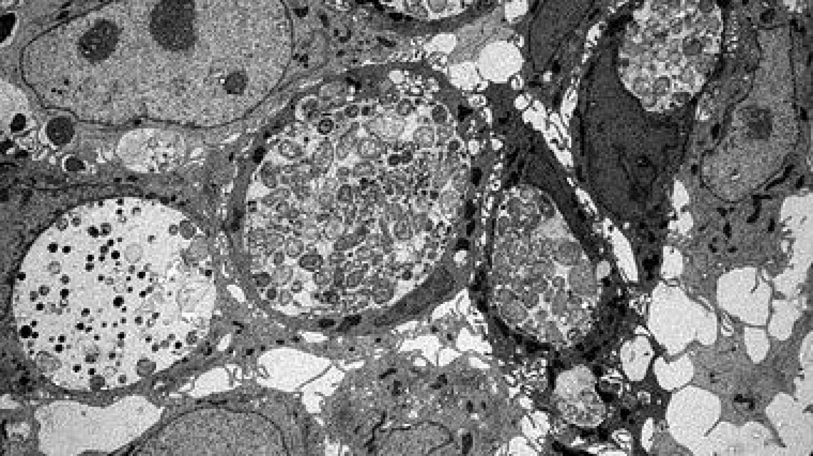 Desarrollan una IA capaz de detectar células cancerosas tempranas - Informativo 24h | Ver