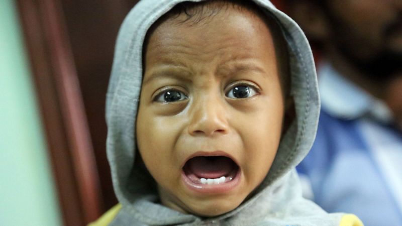 La ONU alerta de la "mayor hambruna en décadas" en Yemen