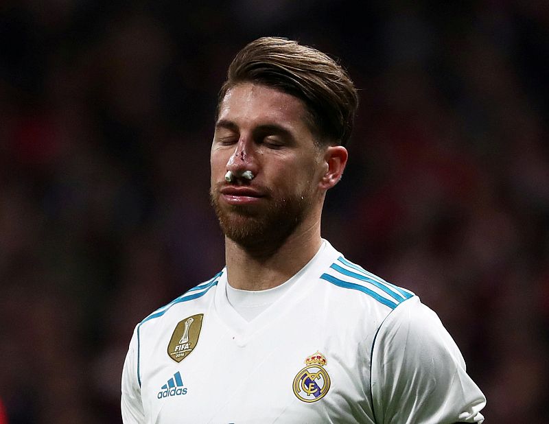 Sergio Ramos sufre una fractura en la nariz por la patada de Lucas en el derbi