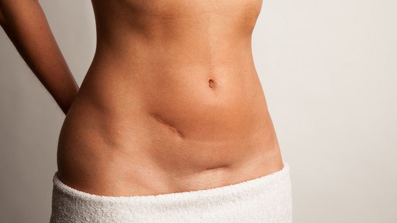 Descubierto un nuevo tratamiento para el cáncer de ovario