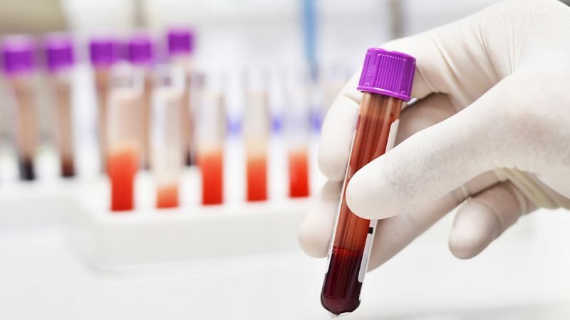 Desarrollan un método para detectar la esclerosis múltiple en muestras de sangre
