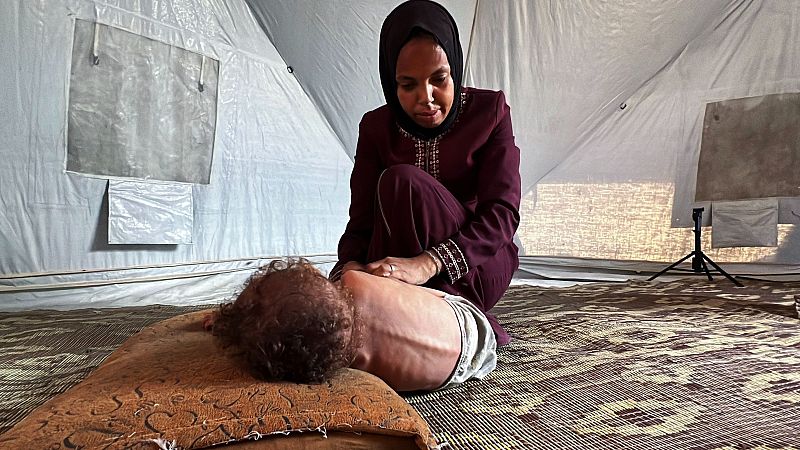 La cifra de niños muertos por desnutrición en Gaza se eleva a 100 desde el inicio de la ofensiva israelí