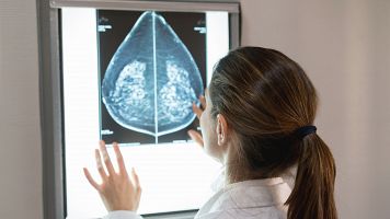 Fiscalía abre diligencias por los errores en el cribado de cáncer de mama en Andalucía