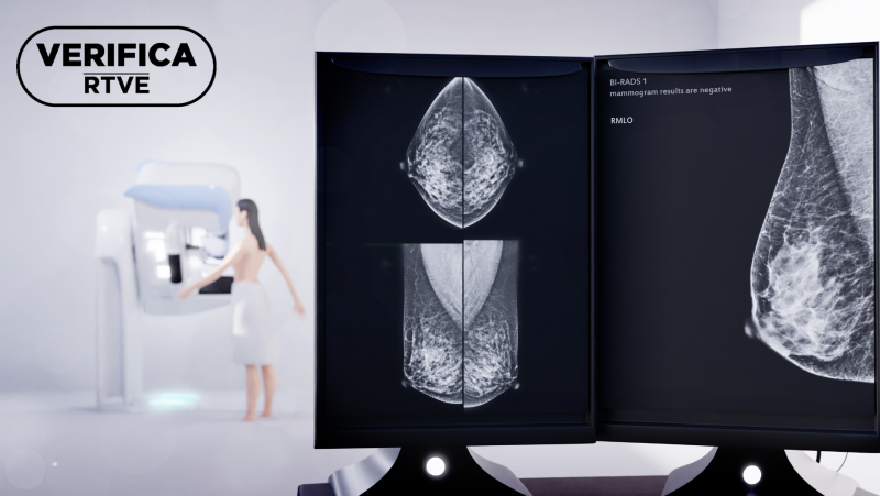 Cncer de mama | Qu son y cmo funcionan los programas de cribado en Espaa?