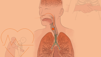 Atragantamientos en Navidad: c�mo ocurren y c�mo evitarlos