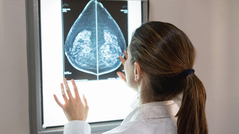Sanidad aprueba la financiación de la primera terapia para cáncer de pulmón genético