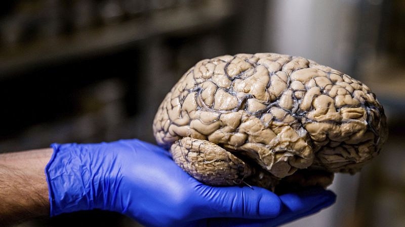 El déjà vu es un "truco del cerebro" y no algo sobrenatural , según un estudio