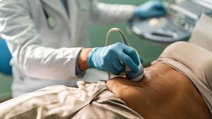 C�ncer de p�ncreas.