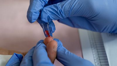 Un nuevo m�todo permite detectar el alzh�imer con una gota de sangre