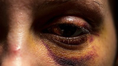 Para que veas - Día Internacional de la Mujer - 08/03/18 - Escuchar ahora