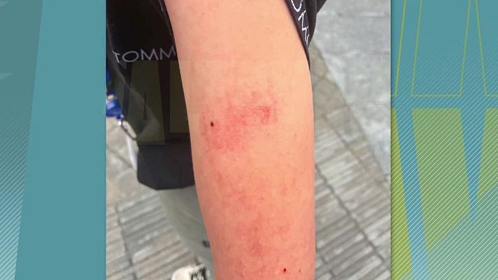 Una mare denuncia agressions reiterades al seu fill per part d'un professor