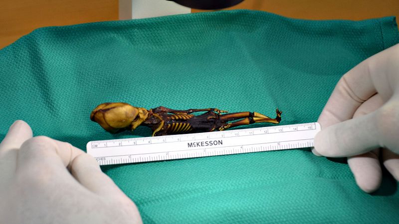 El esqueleto de Atacama era un feto de una niña con varias mutaciones óseas
