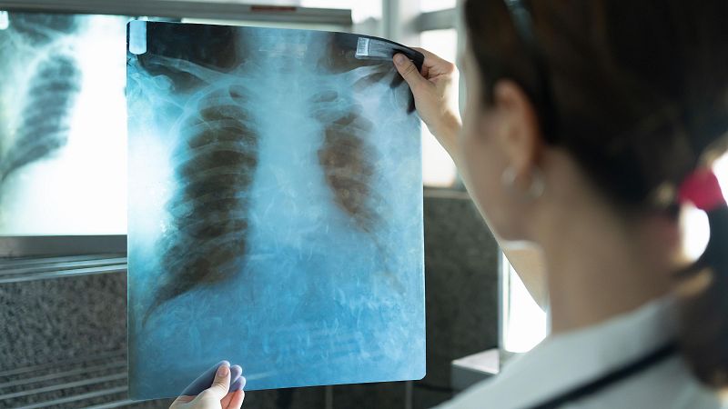 Pa�s Vasco detecta un caso de tuberculosis en un ni�o escolarizado en Bilbao