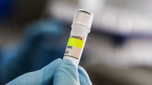 Robles dice que la cuarentena por hantavirus para los espa�oles del crucero es voluntaria