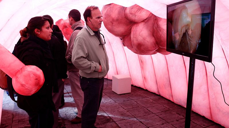 Un tercio de los pacientes con cáncer de colon tiene metástasis en el momento del diagnóstico