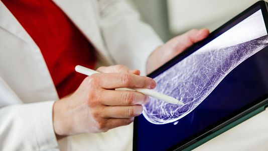 Sanidad amplia el cribado de c�ncer de mama a mujeres de entre 45 y 74 a�os