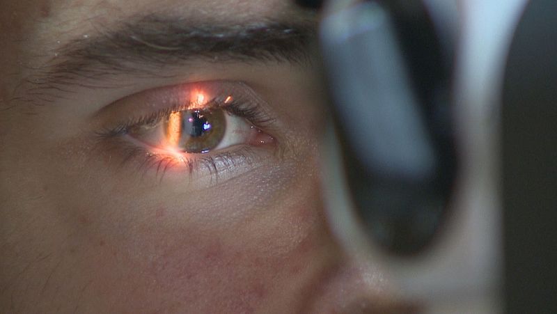Mirar un eclipse sin protección puede causar daños irreversibles: retinopatía ocular