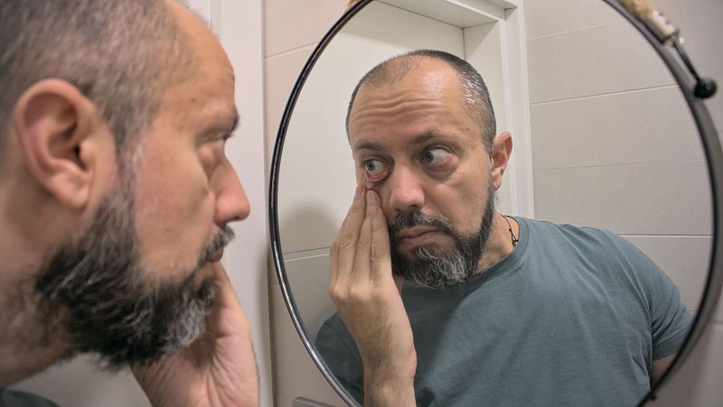 ¿Te pasaste de "mirón" con el eclipse? Guía para saber si tus ojos están "fritos" o solo cansados