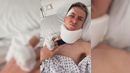Imagen de Pogacar en su Instagram tras la ca�da que le hace abandonar la Vuelta