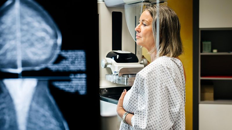 El c�ncer de mama afecta 1 de cada 8 dones