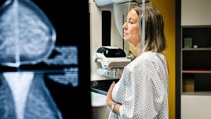 Una mujer se somete a una mamograf�a