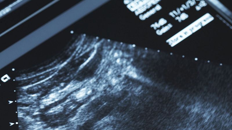 Un estudio halla un vínculo entre la placenta y el desarrollo de la esquizofrenia