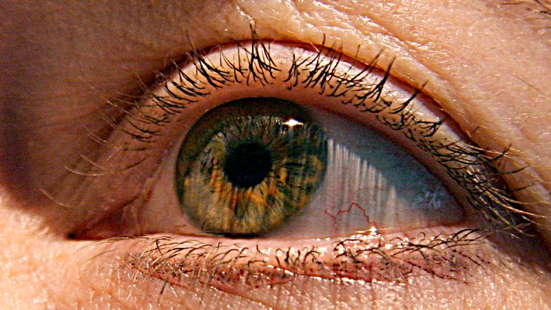 Un simple examen ocular podría detectar evidencias tempranas de padecer alzhéimer