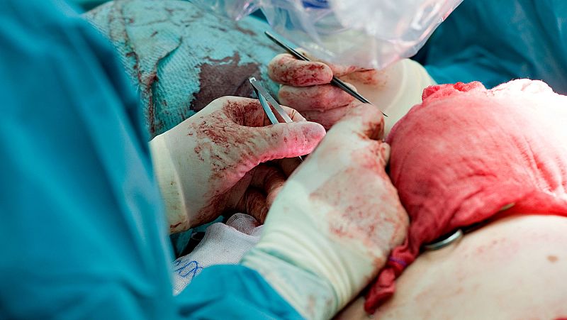 España mantiene su liderato mundial en trasplantes por vigésimo sexto año consecutivo