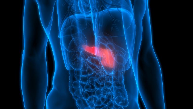 La inmunoterapia con "células asesinas" ofrece una cura potencial para el cáncer de páncreas avanzado