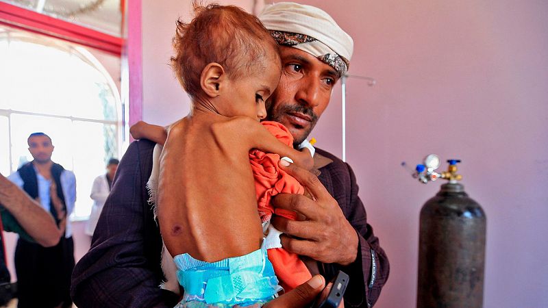 Estados Unidos pide un alto el fuego en la guerra de Yemen