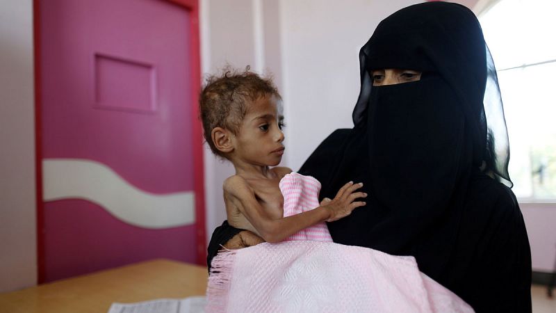 La vida de 400.000 niños yemeníes peligra por malnutrición severa aguda según denuncia Unicef