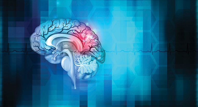 Identifican un gen vital en la recuperación tras sufrir un ictus